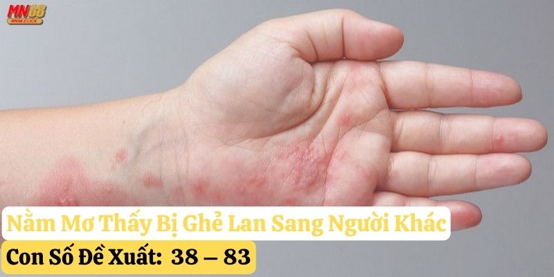 mơ thấy bị ghẻ