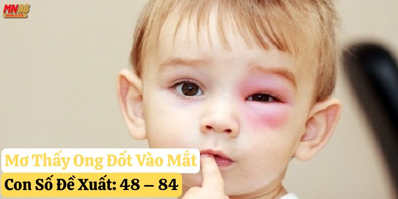 nằm mơ thấy ong đốt