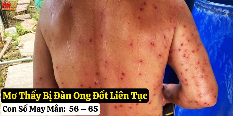 mơ thấy ong đốt