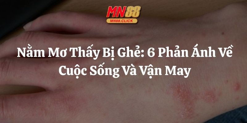nằm mơ thấy bị ghẻ mn88 thumb