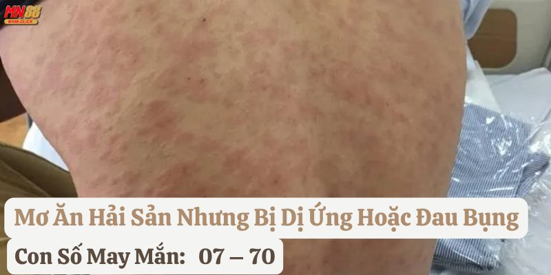 mơ ăn hải sản mn88